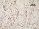 3 - Filamenti con cellule in fase riproduttiva